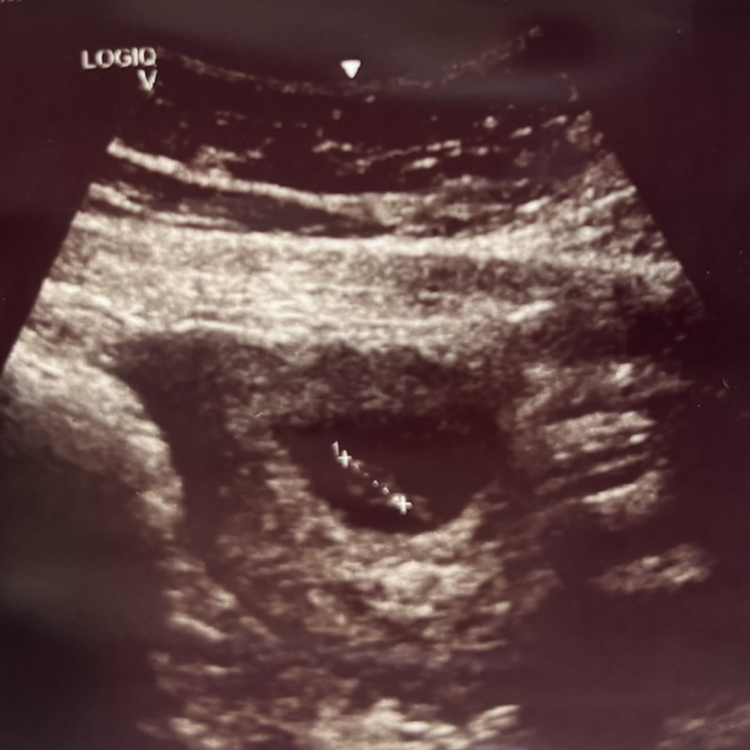 Photo shared by Raquel for their Babylist baby registry.