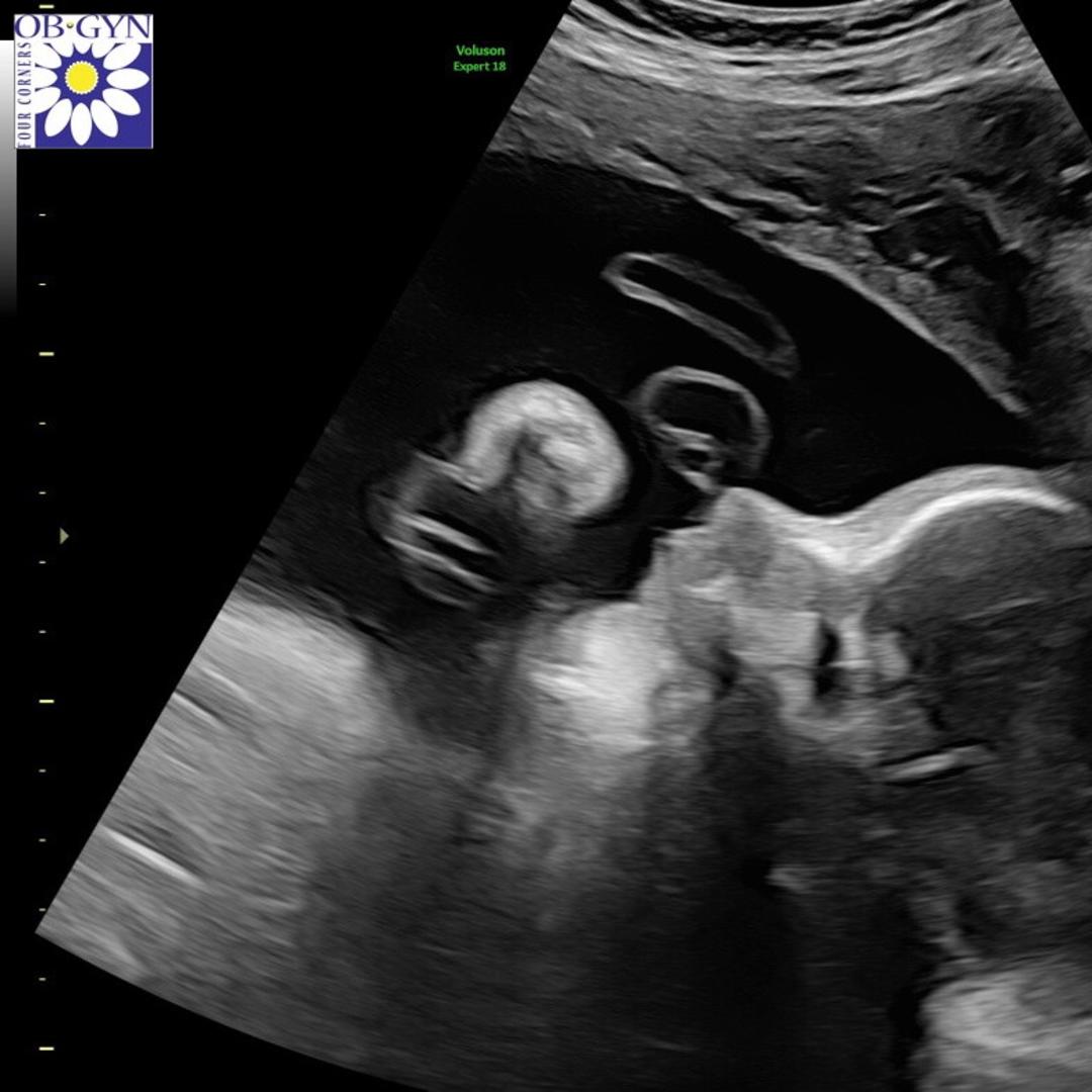 Photo shared by David for their Babylist baby registry.