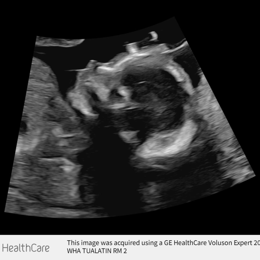 Photo shared by Maddie for their Babylist baby registry.