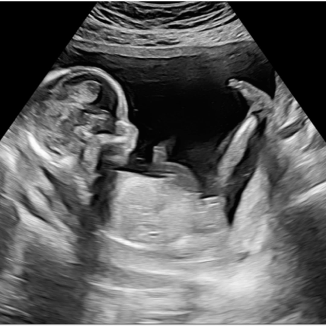 Photo shared by Avery for their Babylist baby registry.