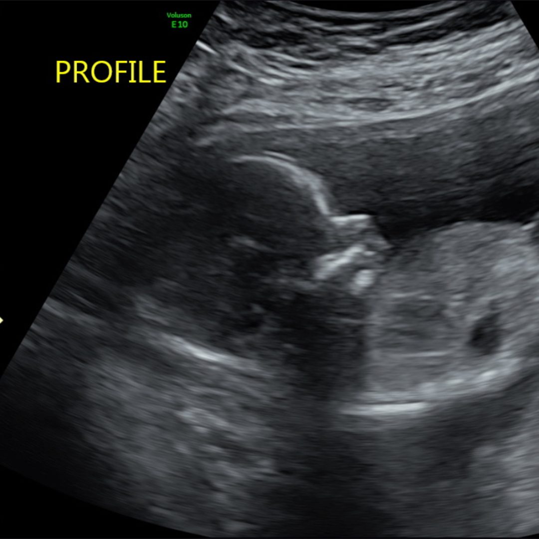 Photo shared by Baylee for their Babylist baby registry.