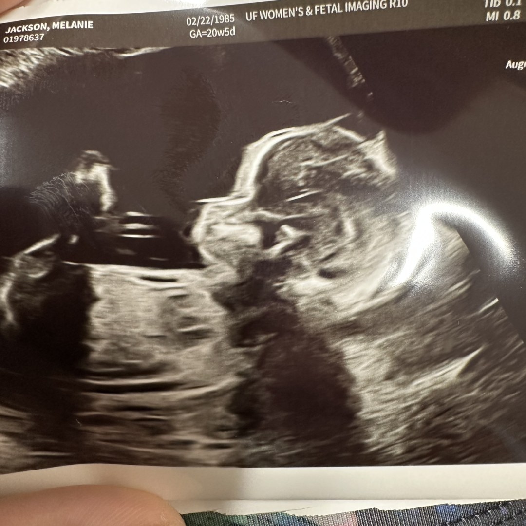 Photo shared by Melanie for their Babylist baby registry.