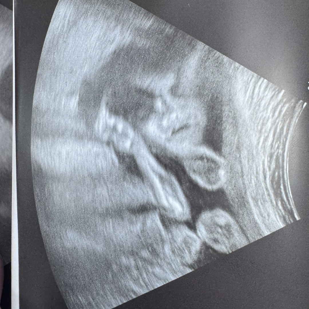 Photo shared by Kendall for their Babylist baby registry.