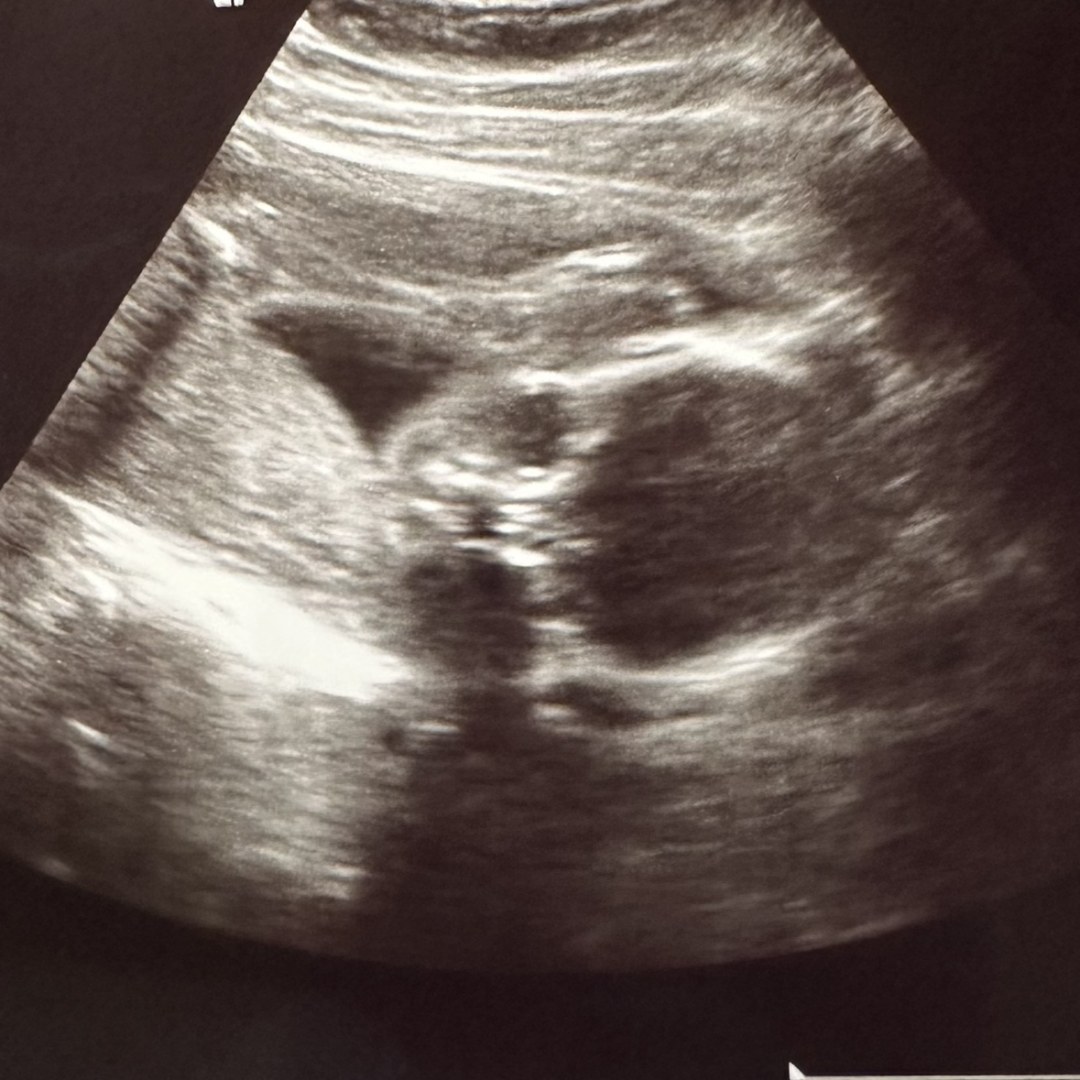 Photo shared by Sara for their Babylist baby registry.