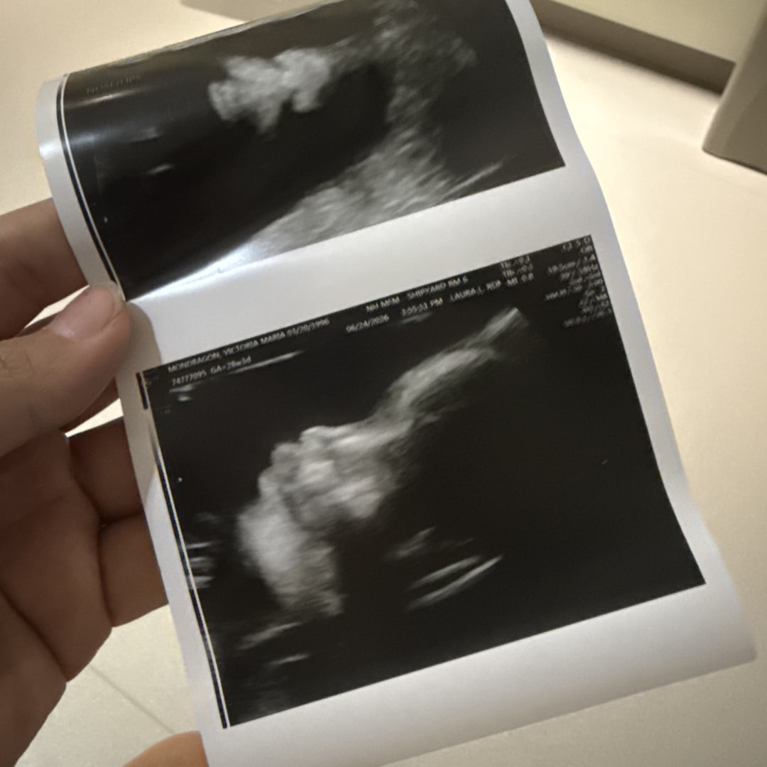 Photo shared by Victoria for their Babylist baby registry.