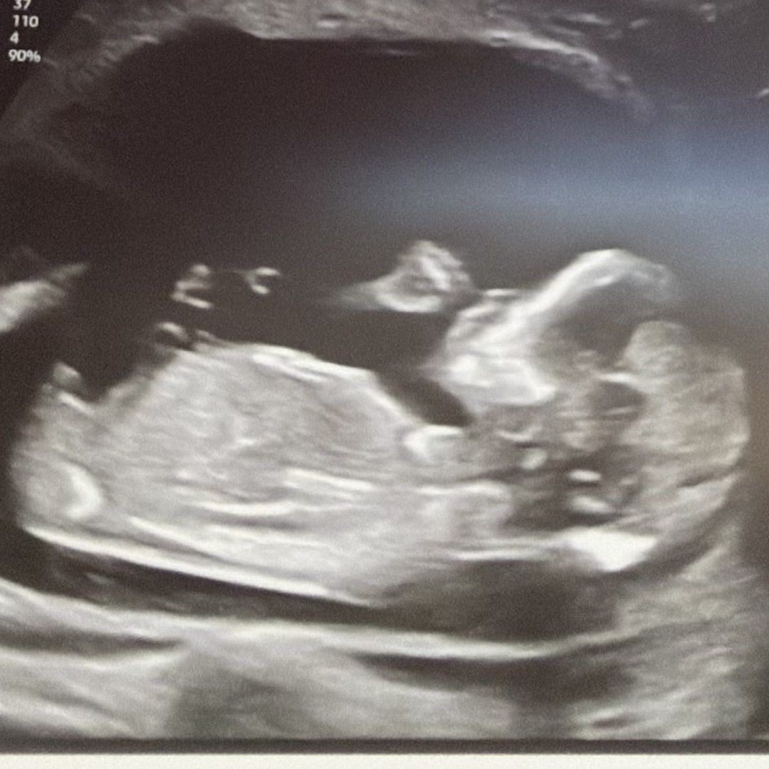 Photo shared by Vivica for their Babylist baby registry.