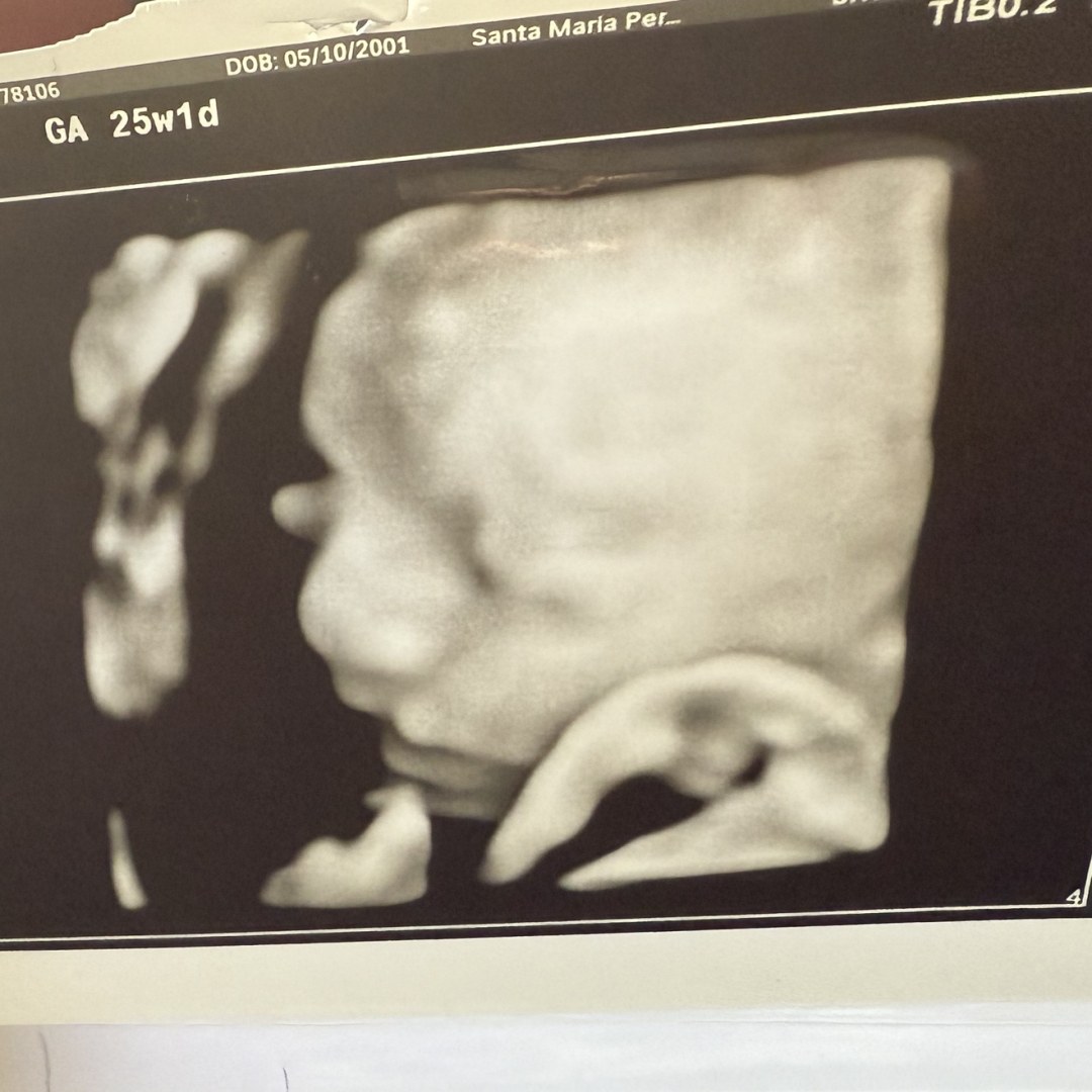 Photo shared by Stephanie for their Babylist baby registry.