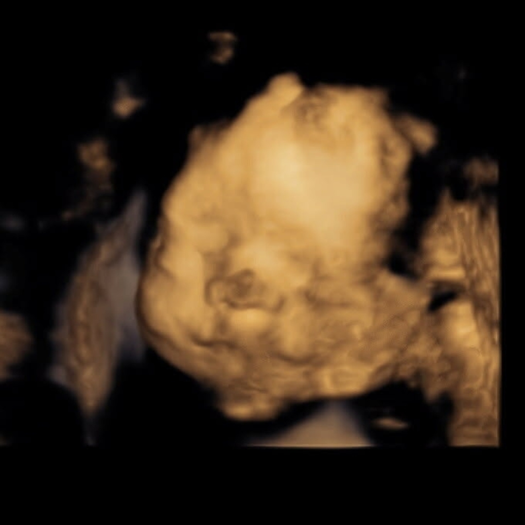 Photo shared by Asheley for their Babylist baby registry.