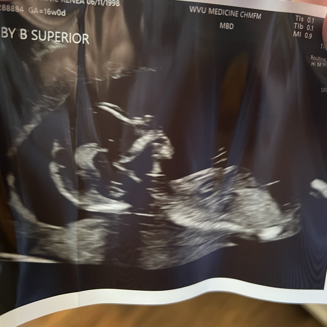 Photo shared by Annie for their Babylist baby registry.