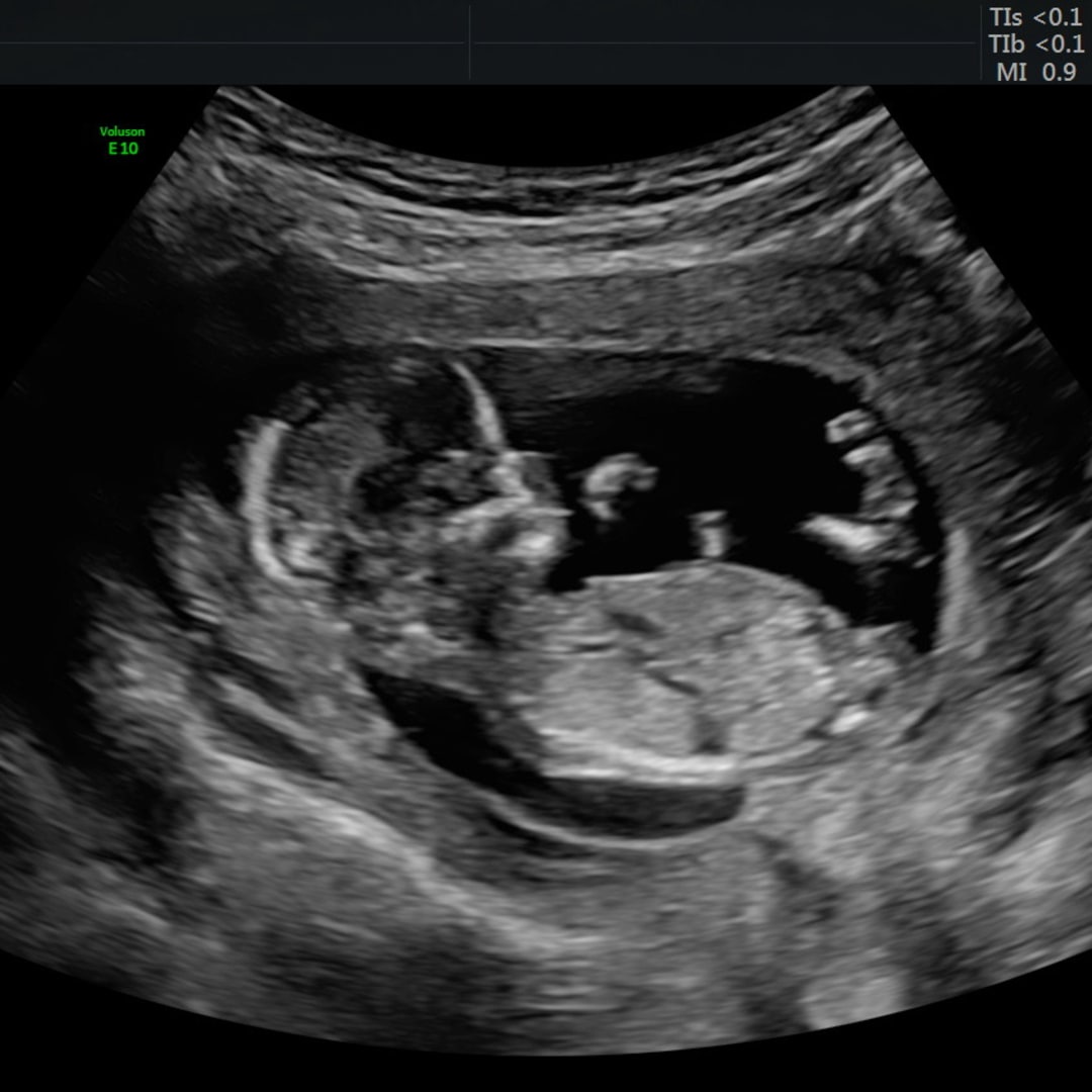 Photo shared by Jennifer for their Babylist baby registry.