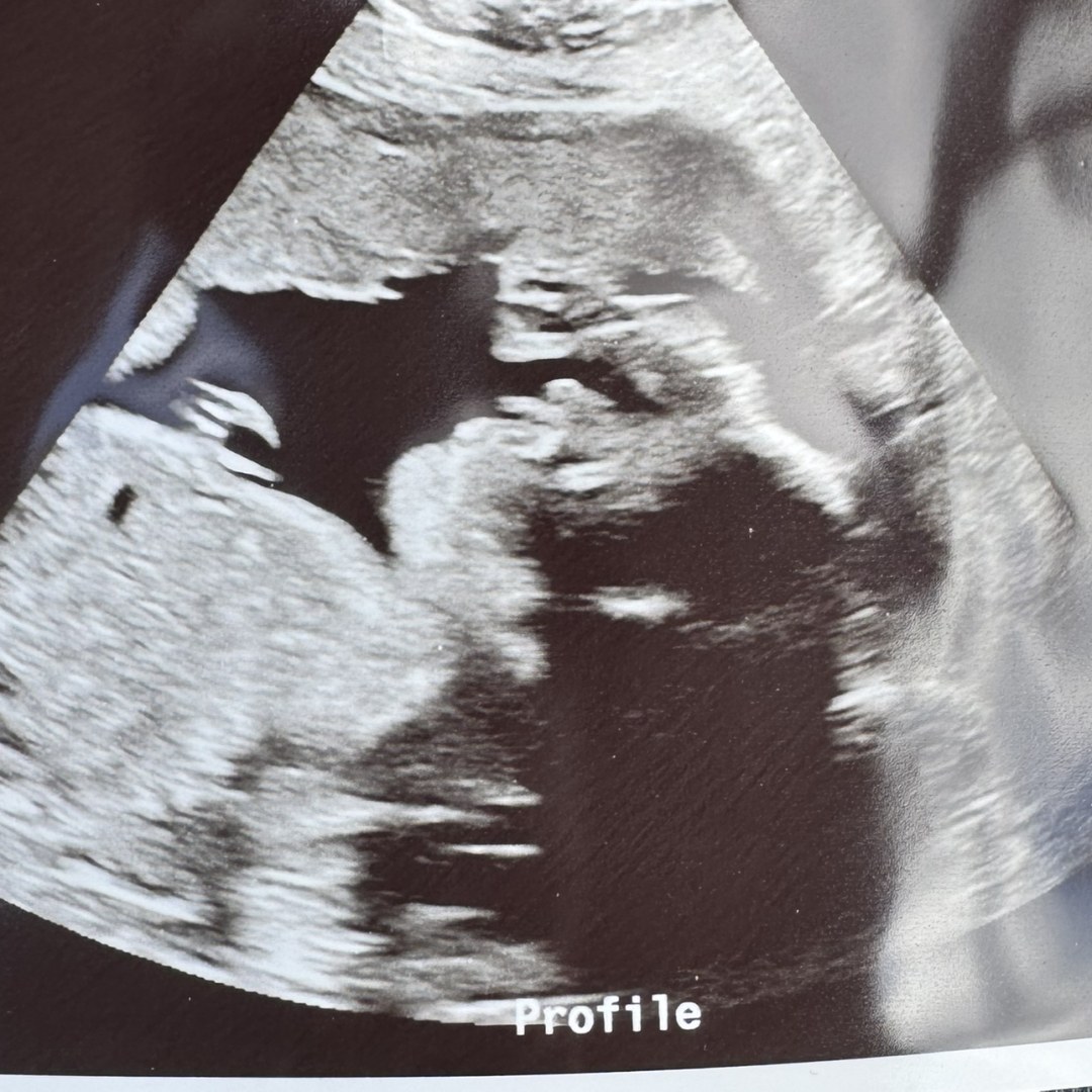 Photo shared by Haley for their Babylist baby registry.
