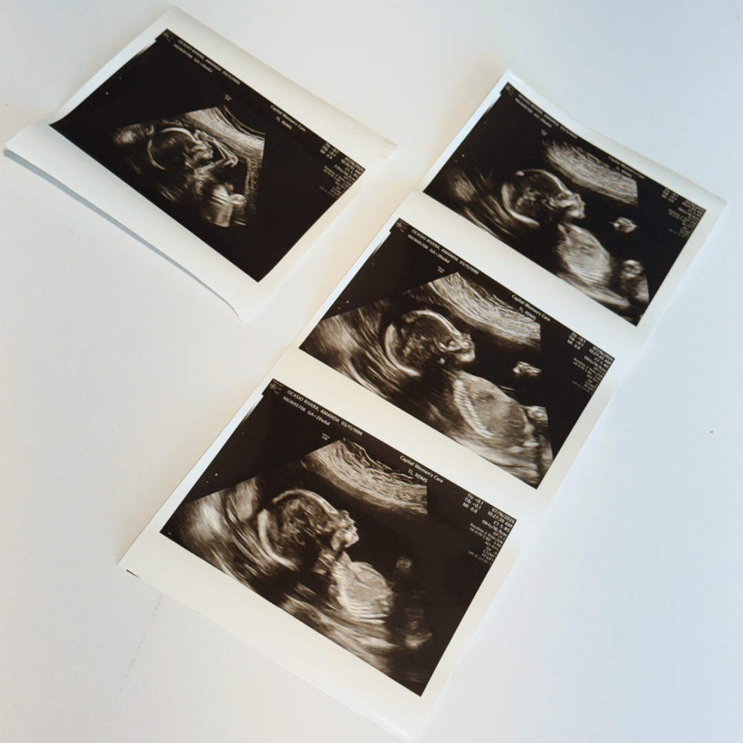 Photo shared by Bryan for their Babylist baby registry.