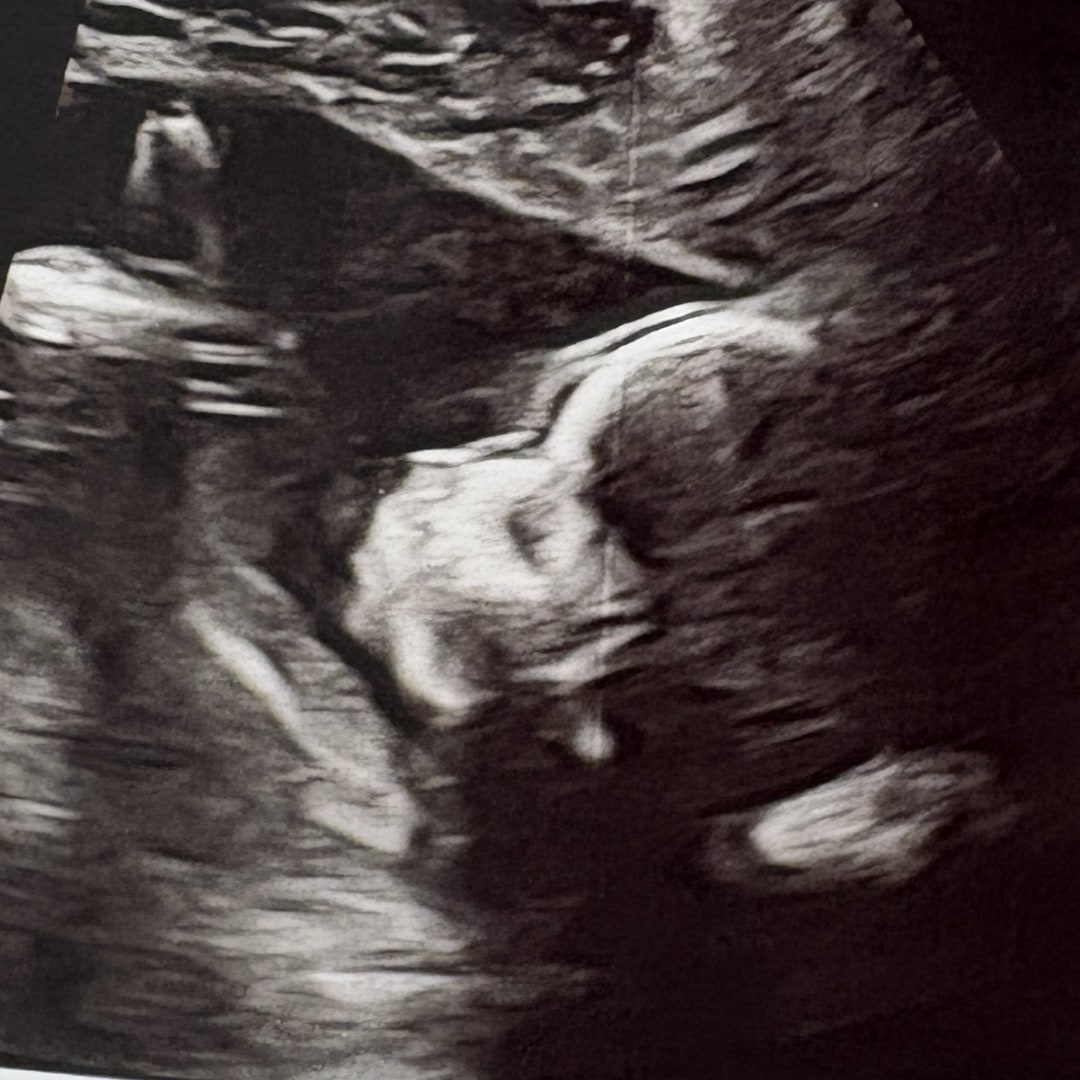 Photo shared by Kaylee for their Babylist baby registry.