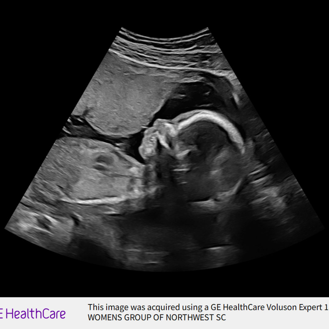 Photo shared by Phelan for their Babylist baby registry.