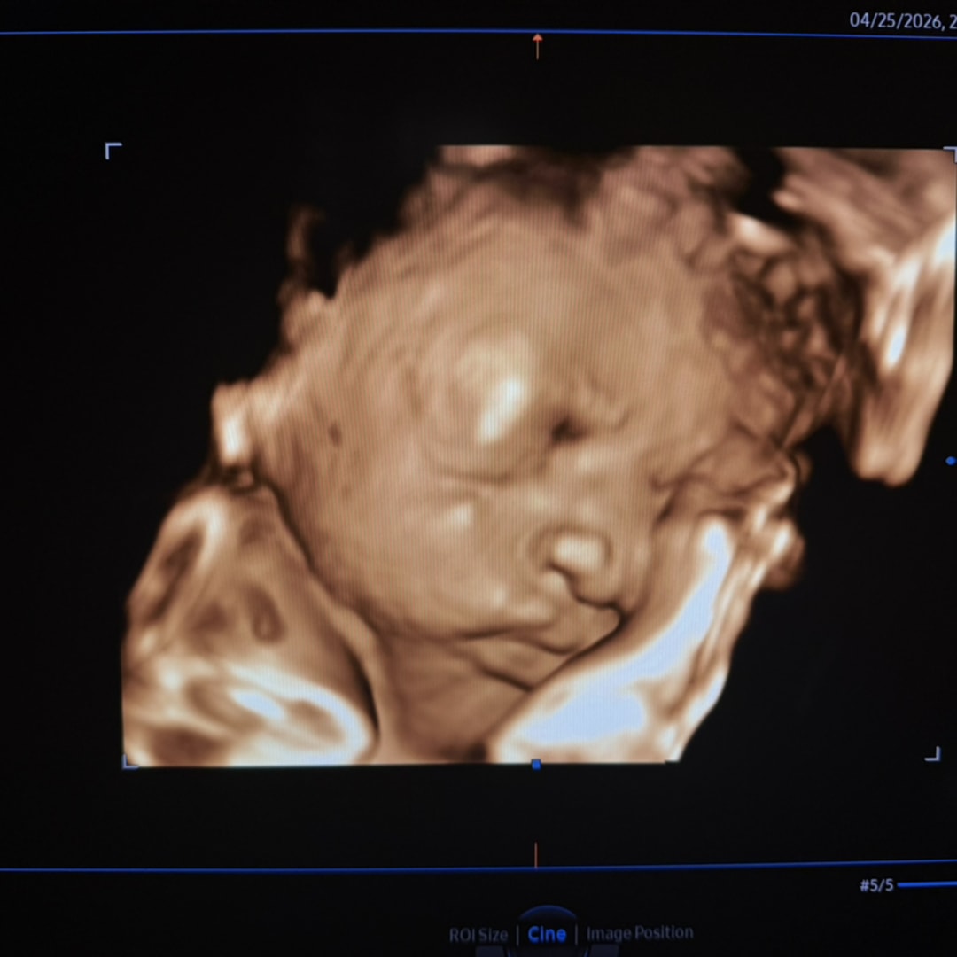 Photo shared by Liliana for their Babylist baby registry.