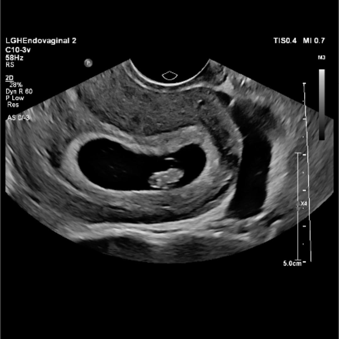 Photo shared by Ileyshka for their Babylist baby registry.