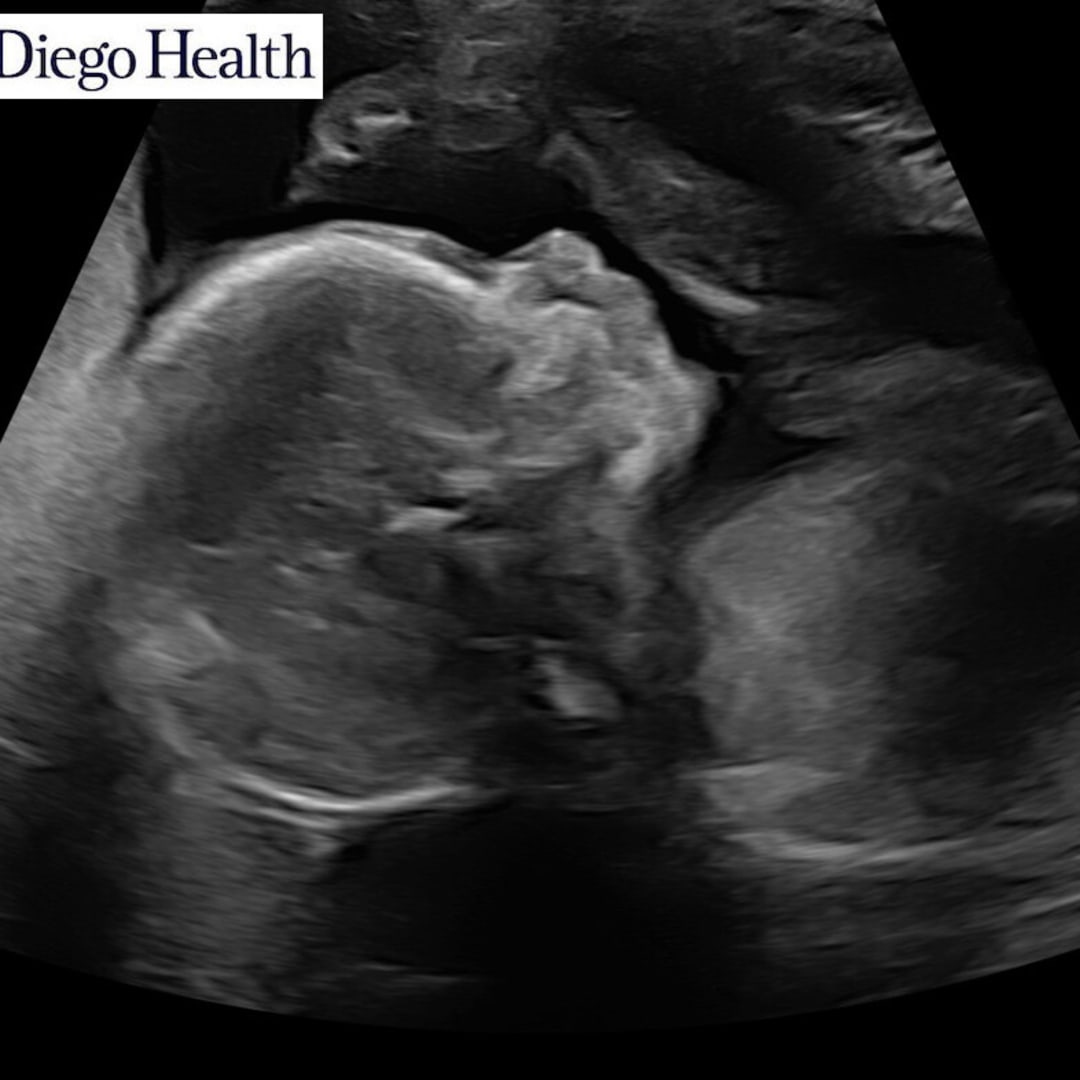 Photo shared by Karine for their Babylist baby registry.