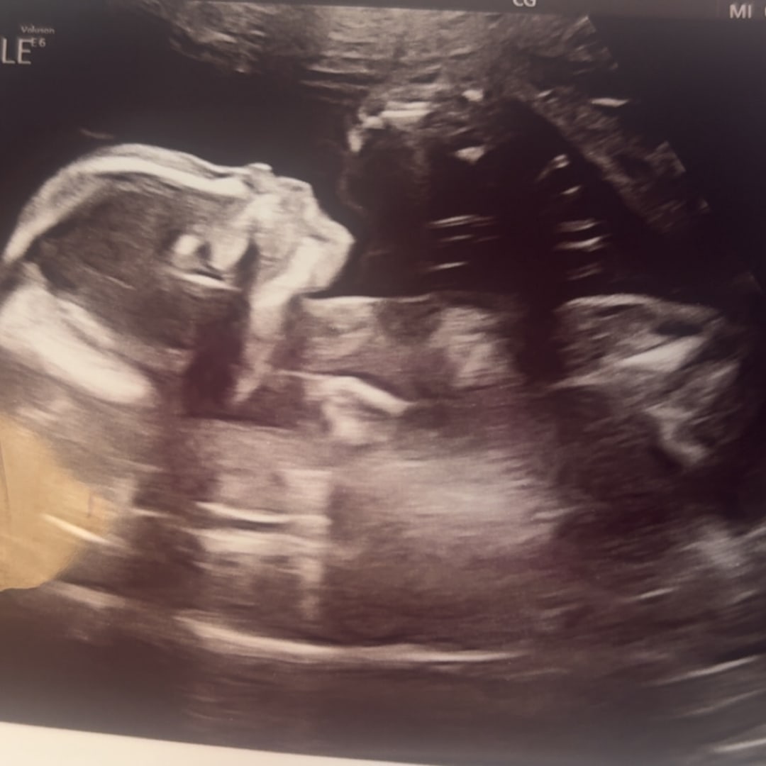 Photo shared by Rayana for their Babylist baby registry.