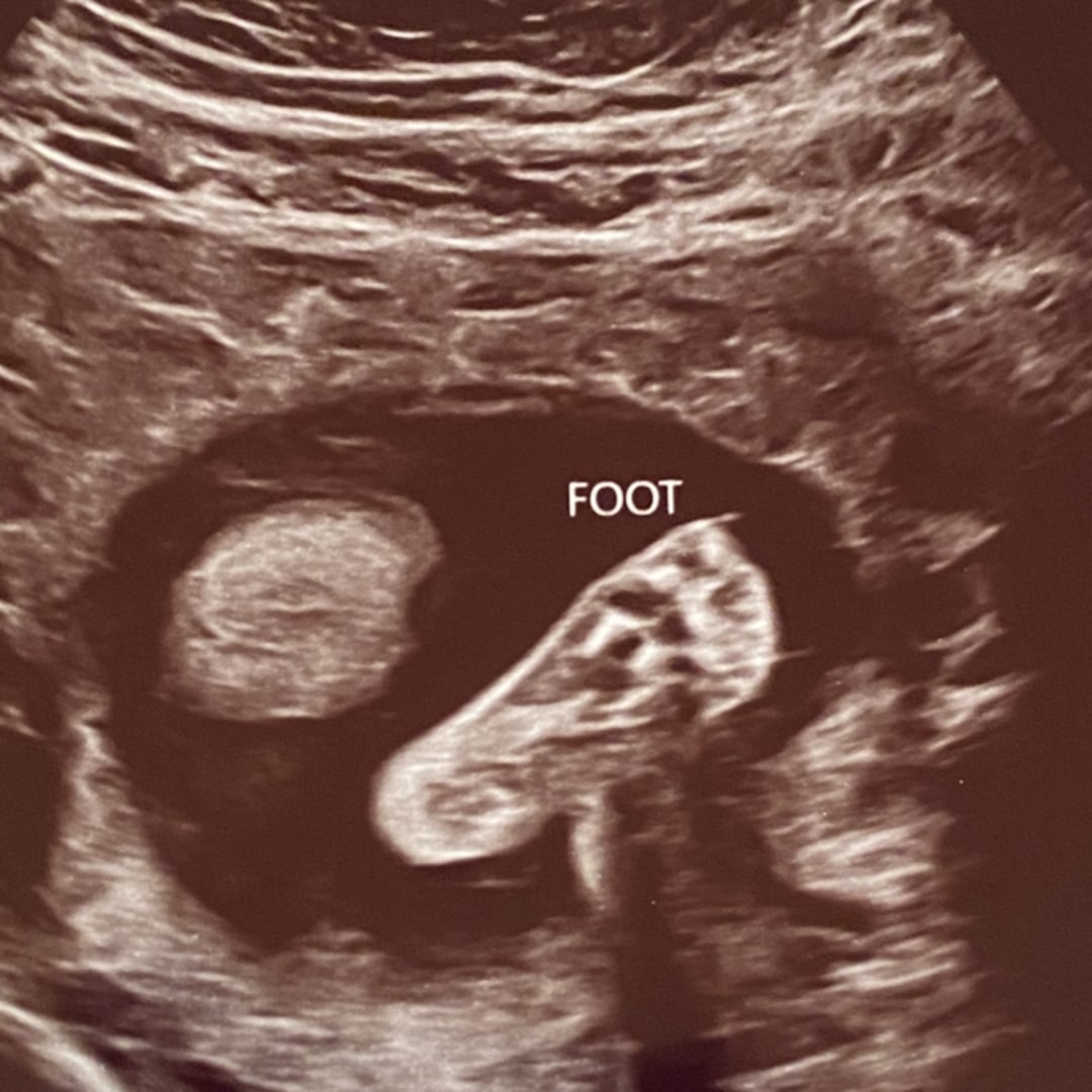 Photo shared by Natalie for their Babylist baby registry.