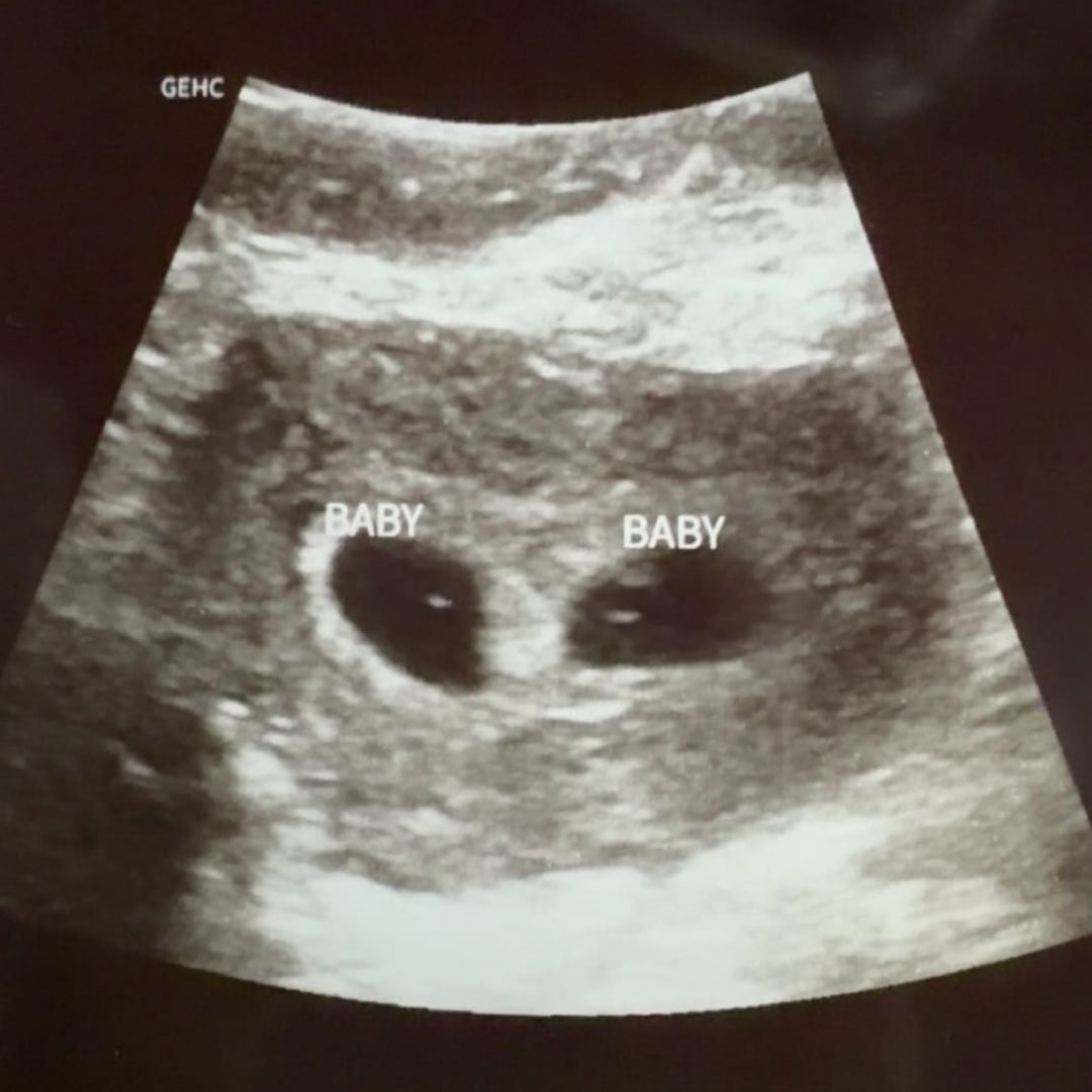 Photo shared by Beretta for their Babylist baby registry.