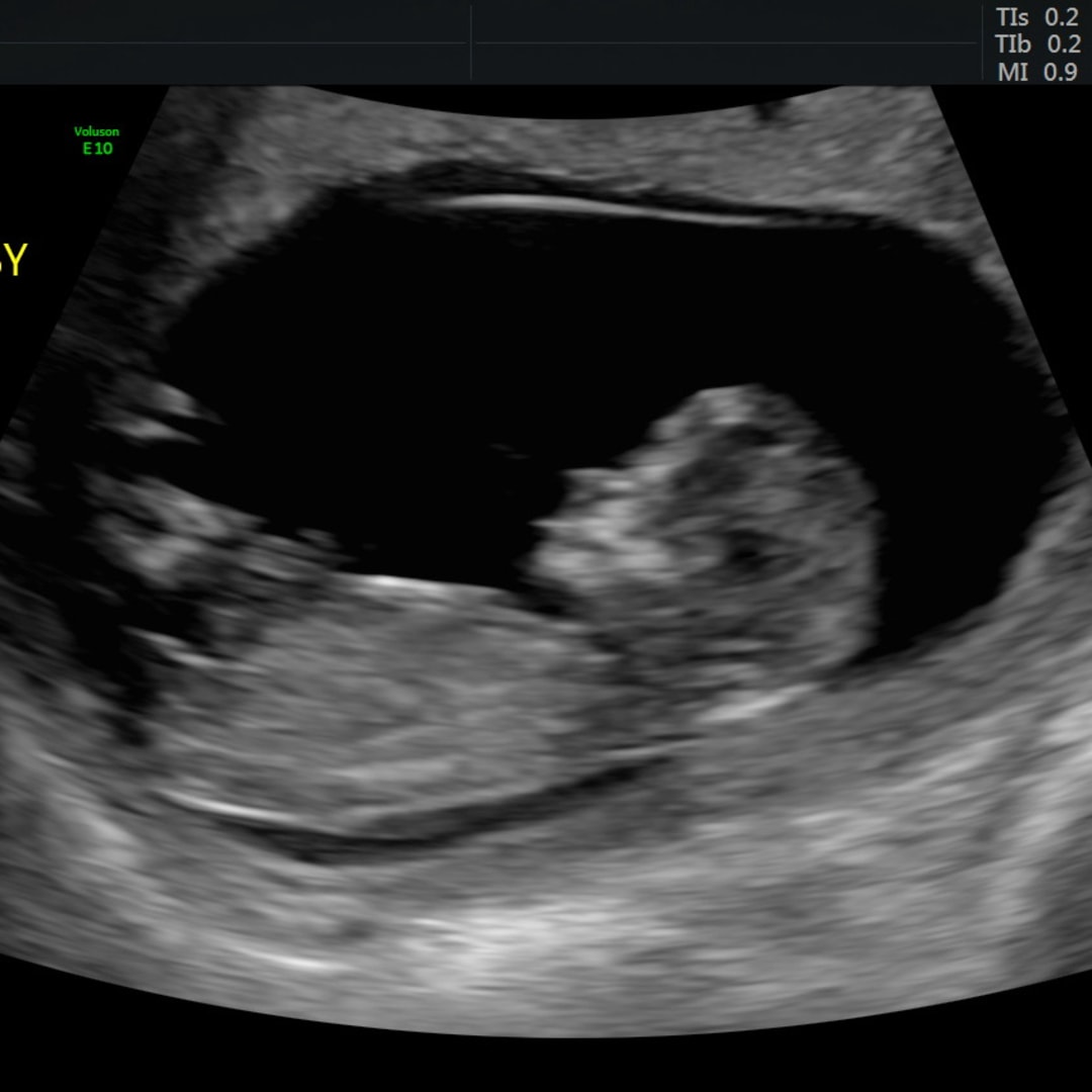 Photo shared by Allison for their Babylist baby registry.