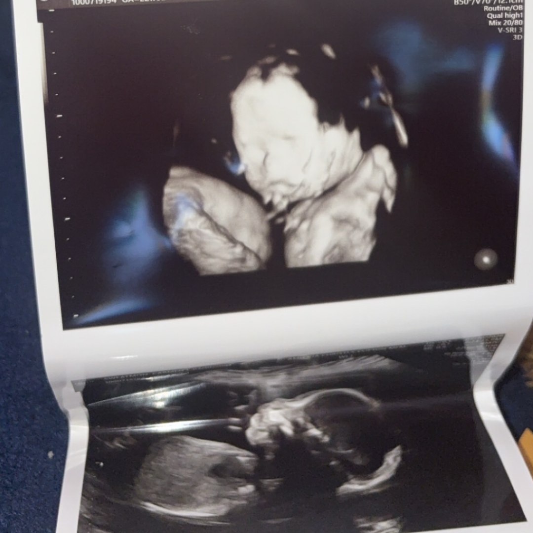 Photo shared by Carmen for their Babylist baby registry.