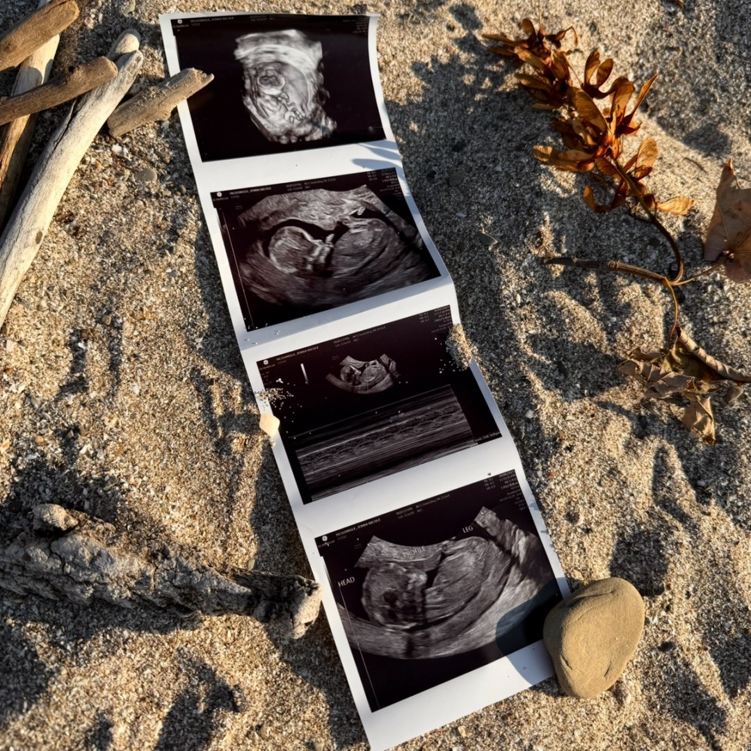 Photo shared by Jenna for their Babylist baby registry.