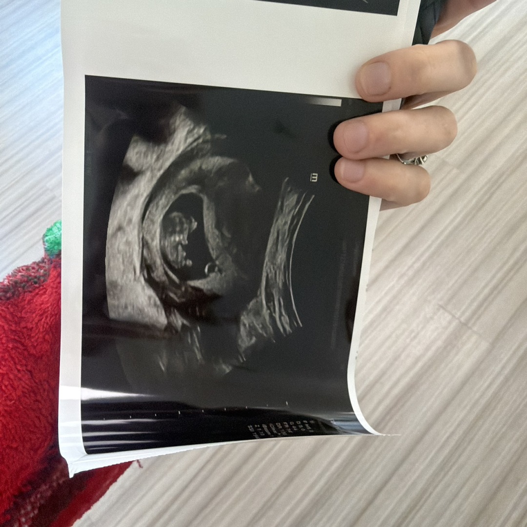 Photo shared by Destin for their Babylist baby registry.