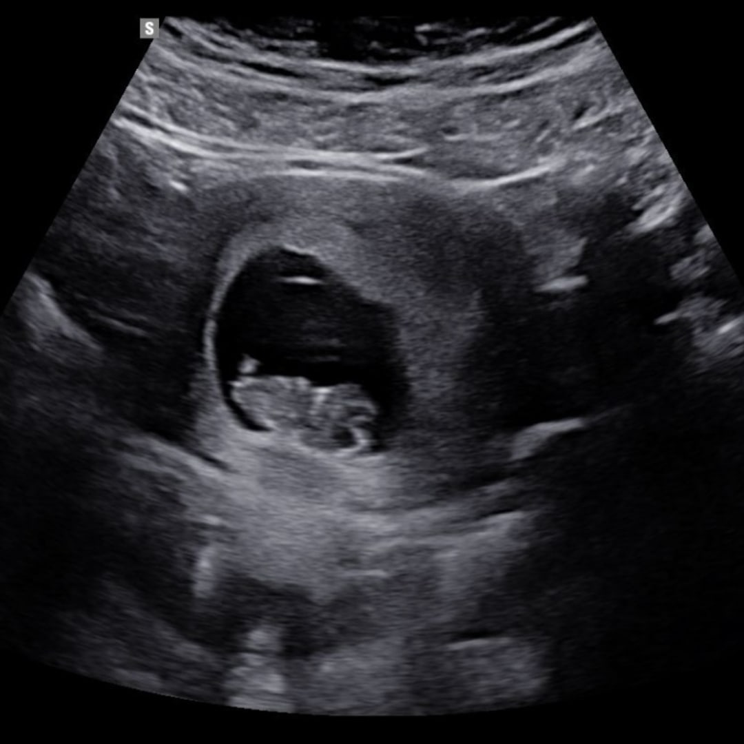 Photo shared by Meghan for their Babylist baby registry.