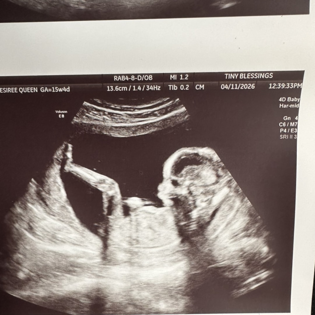 Photo shared by Desiree for their Babylist baby registry.
