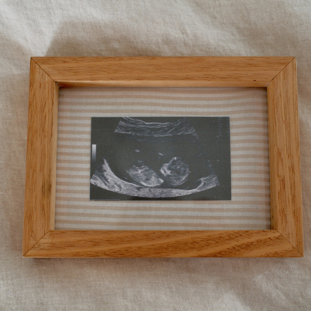 Photo shared by Jemma for their Babylist baby registry.