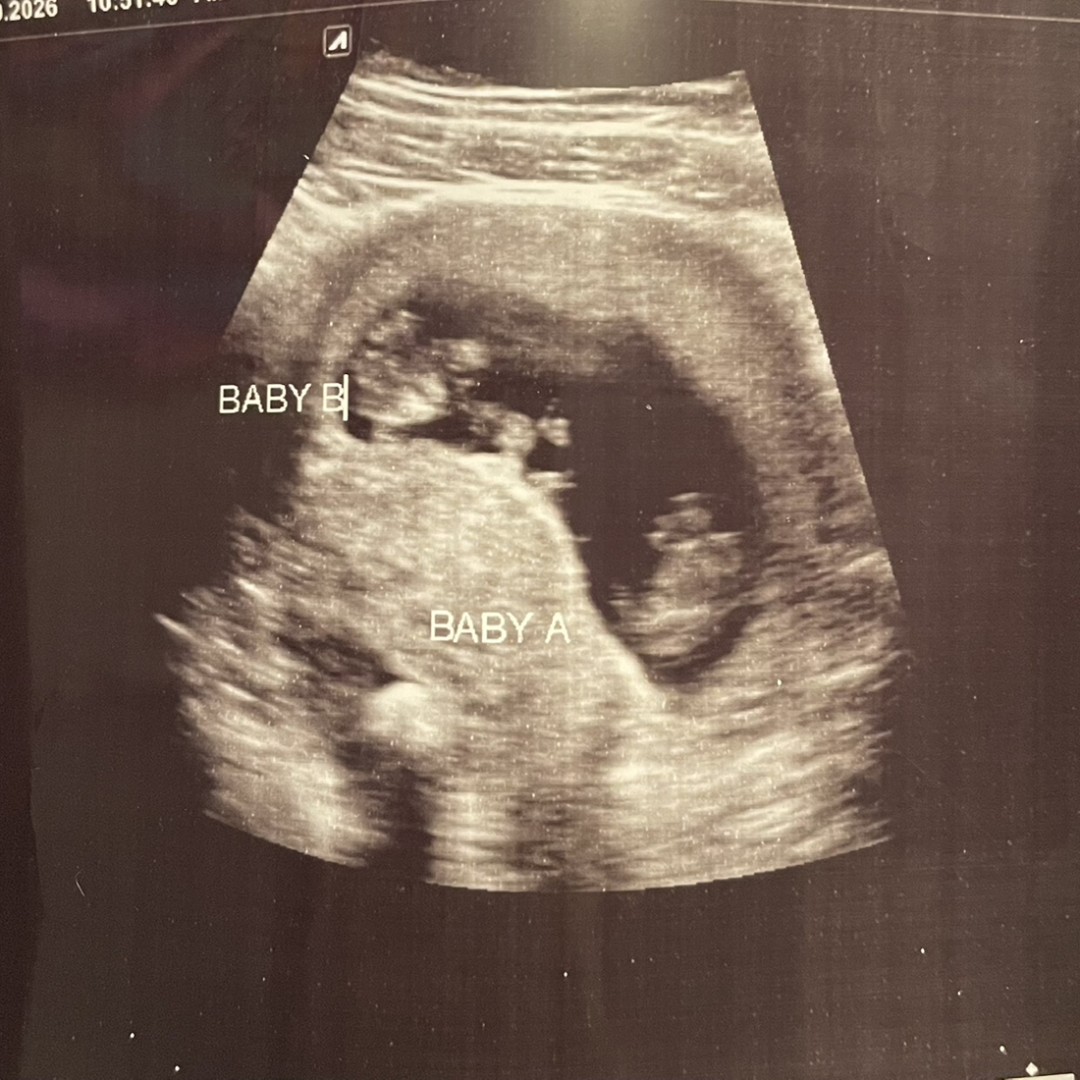 Photo shared by Sadie for their Babylist baby registry.