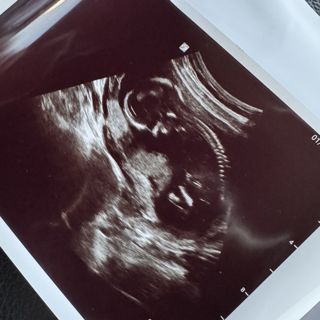 Photo shared by Emily for their Babylist baby registry.