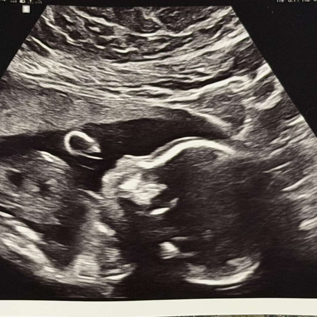 Photo shared by Christina for their Babylist baby registry.