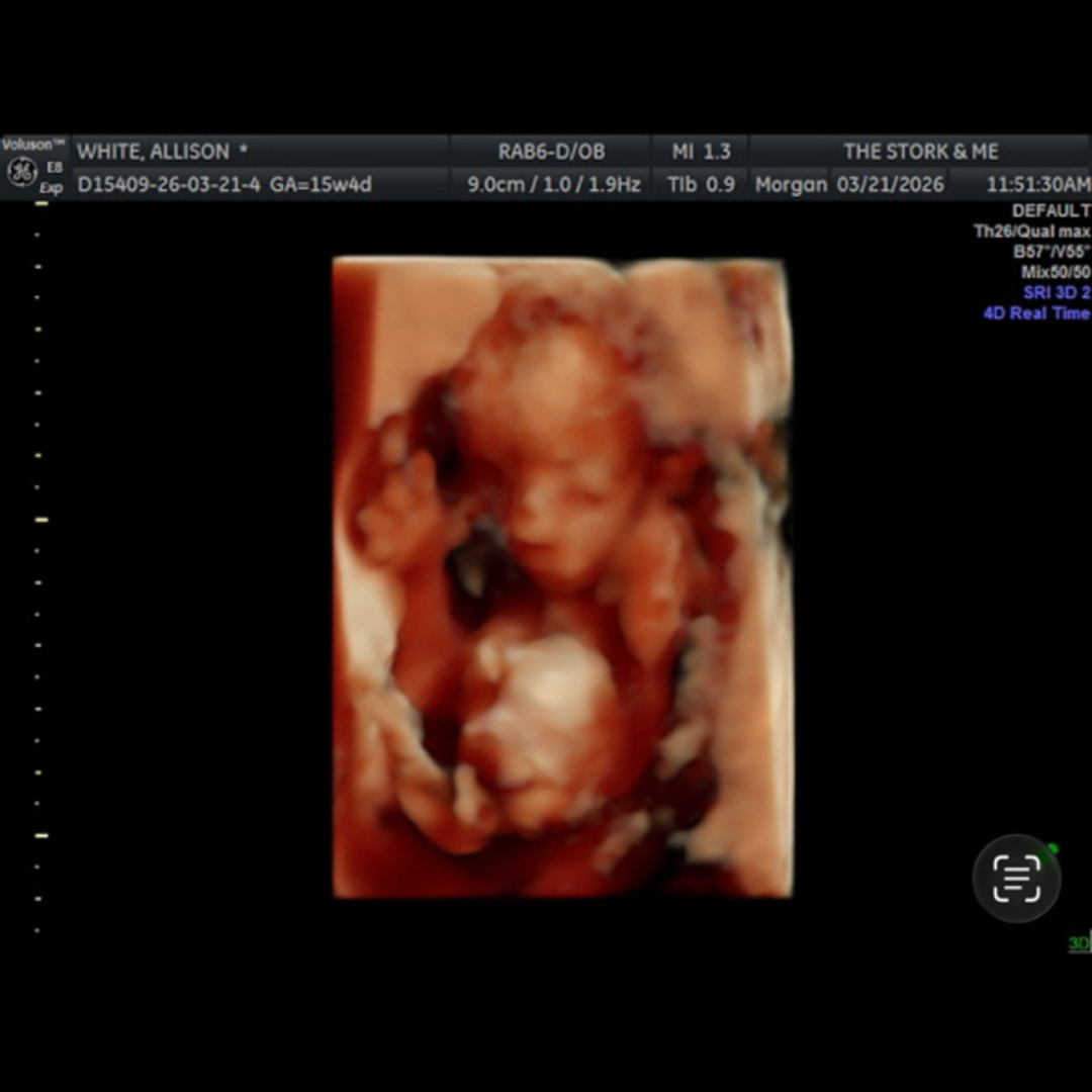 Photo shared by Allison for their Babylist baby registry.