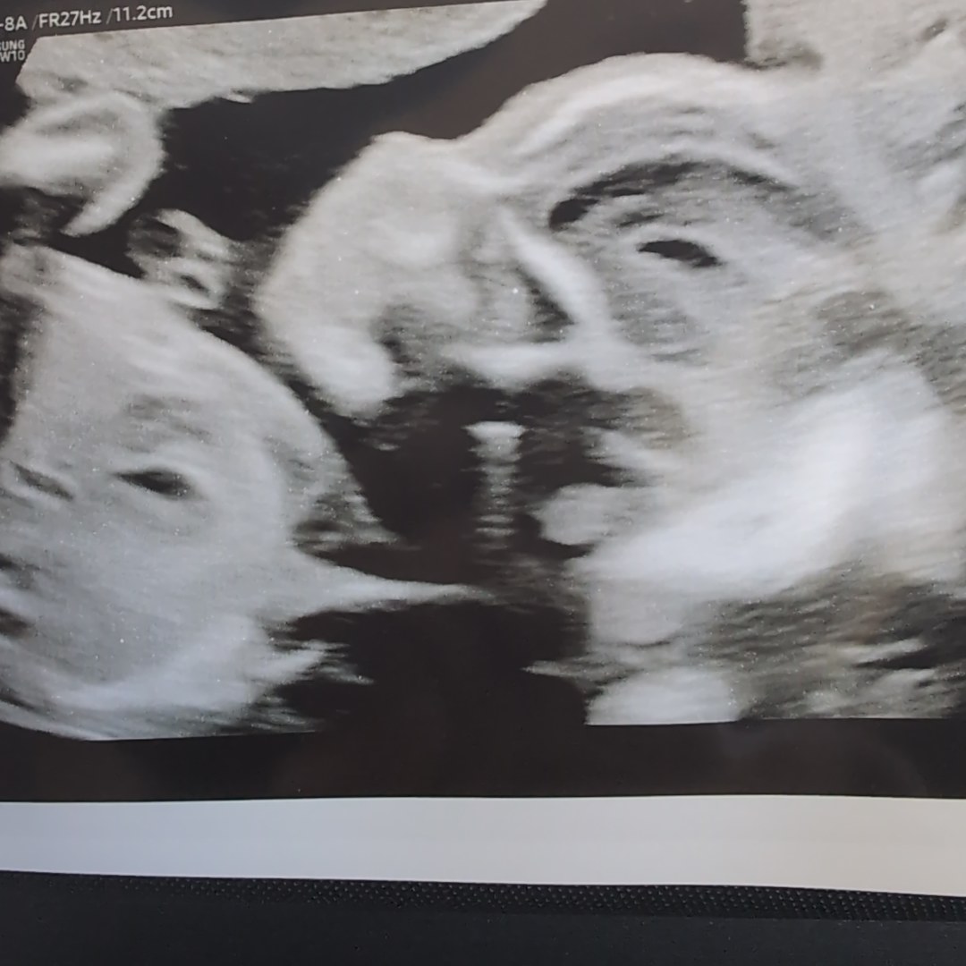 Photo shared by Marissa for their Babylist baby registry.