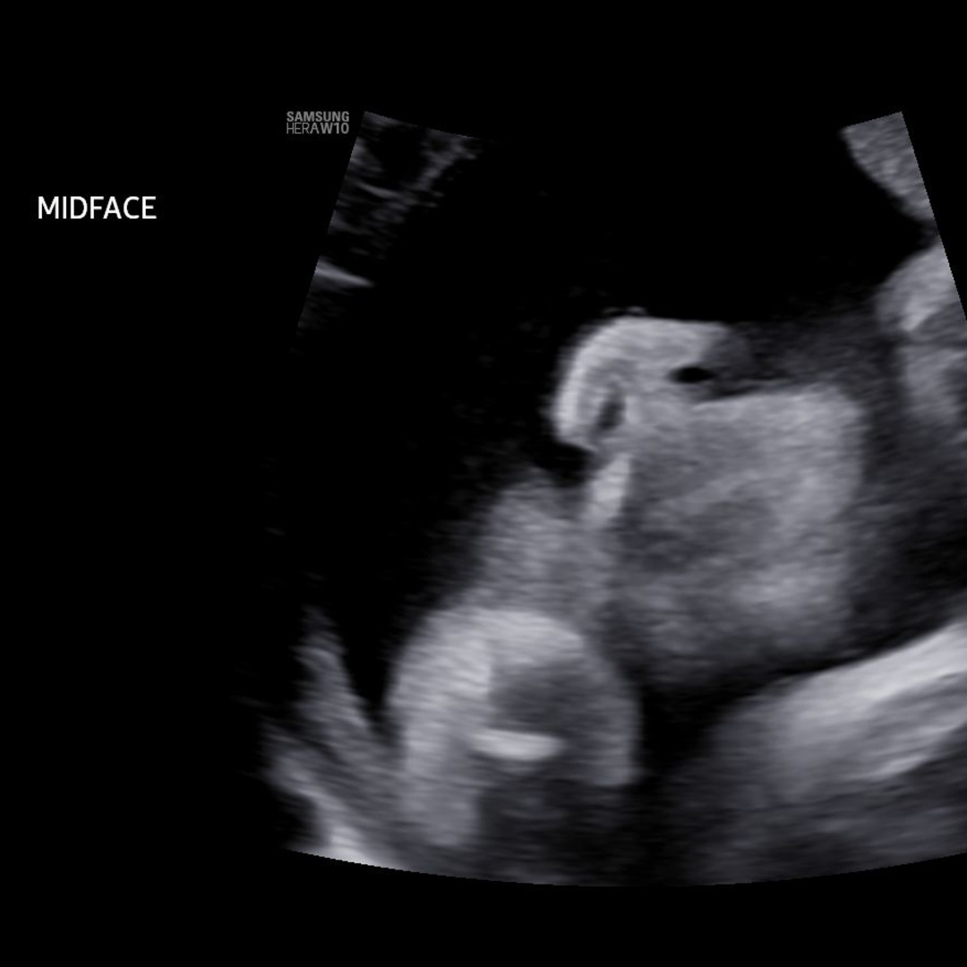 Photo shared by Ilana for their Babylist baby registry.