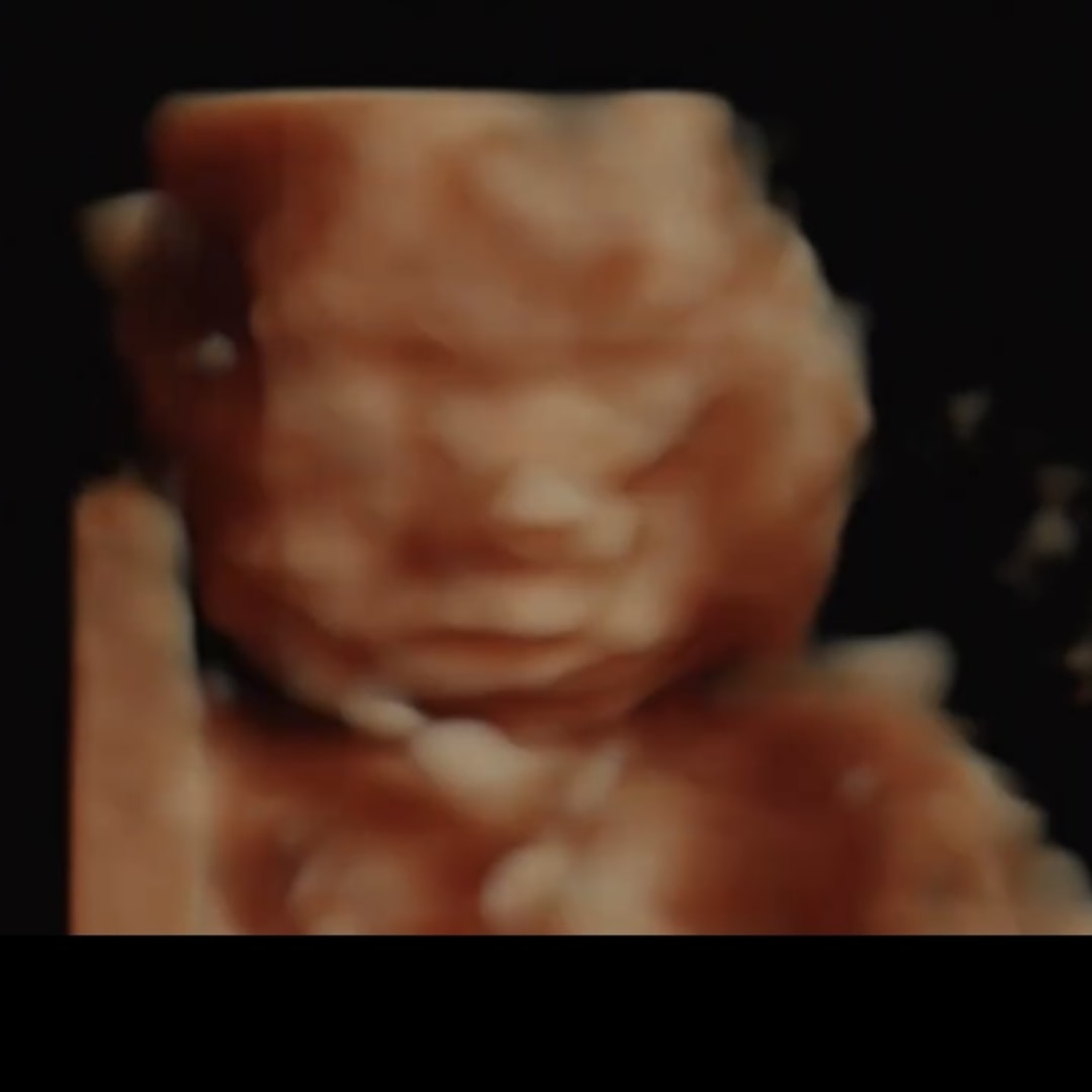 Photo shared by Morgan for their Babylist baby registry.