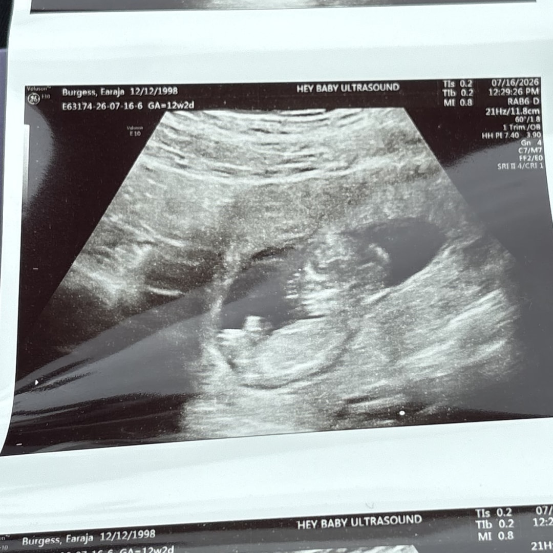 Photo shared by Earaja for their Babylist baby registry.