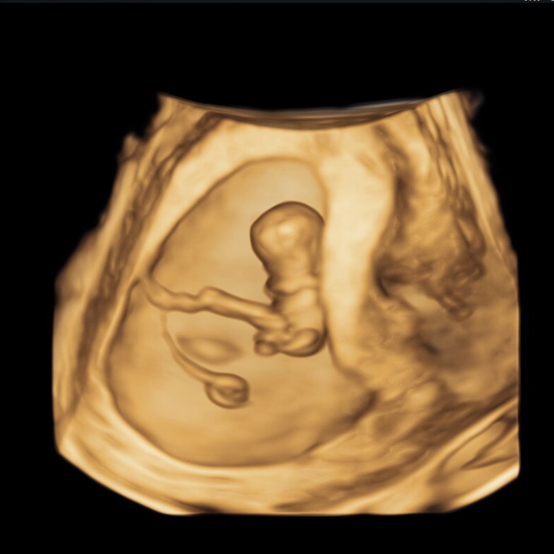 Photo shared by Madi for their Babylist baby registry.