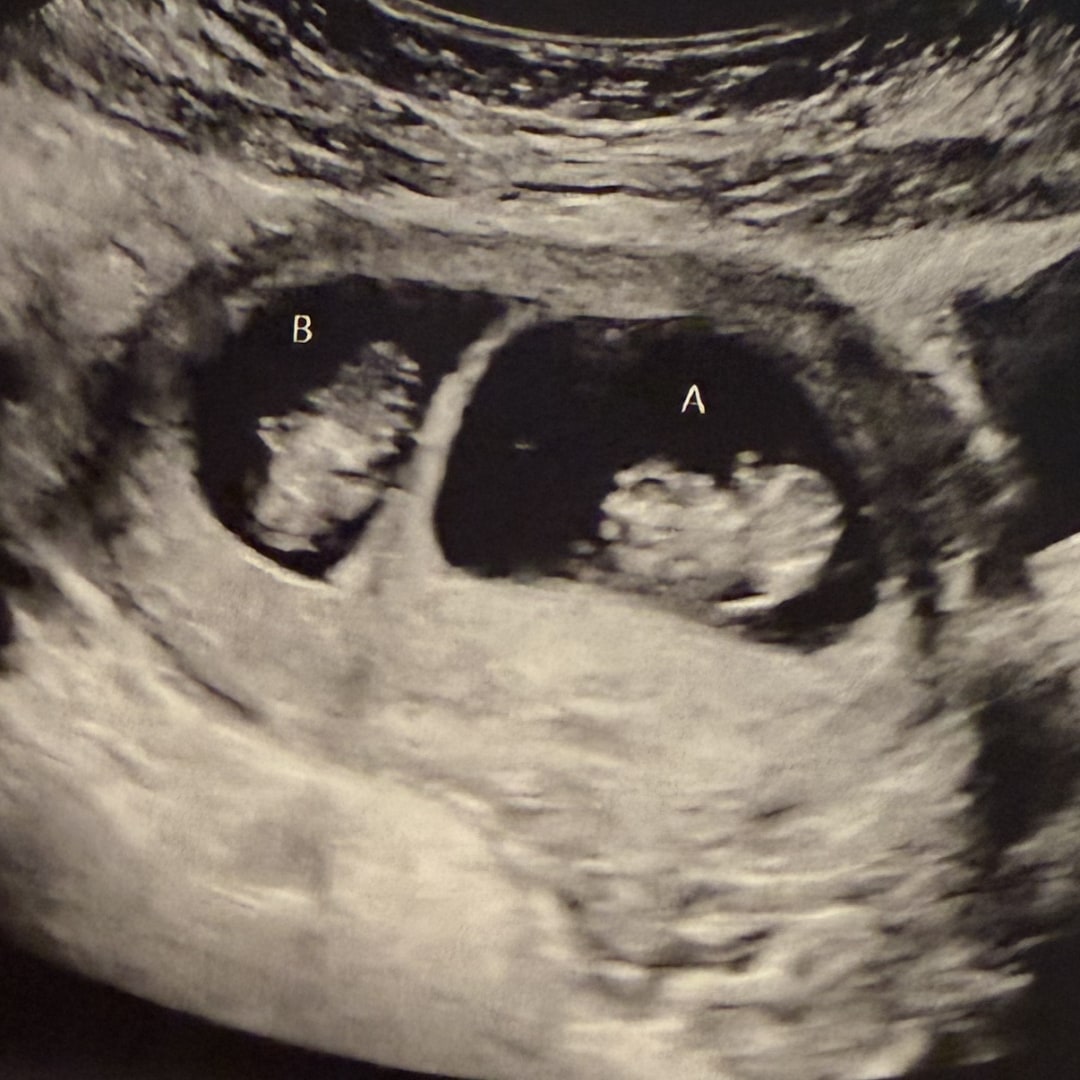 Photo shared by Brianna for their Babylist baby registry.