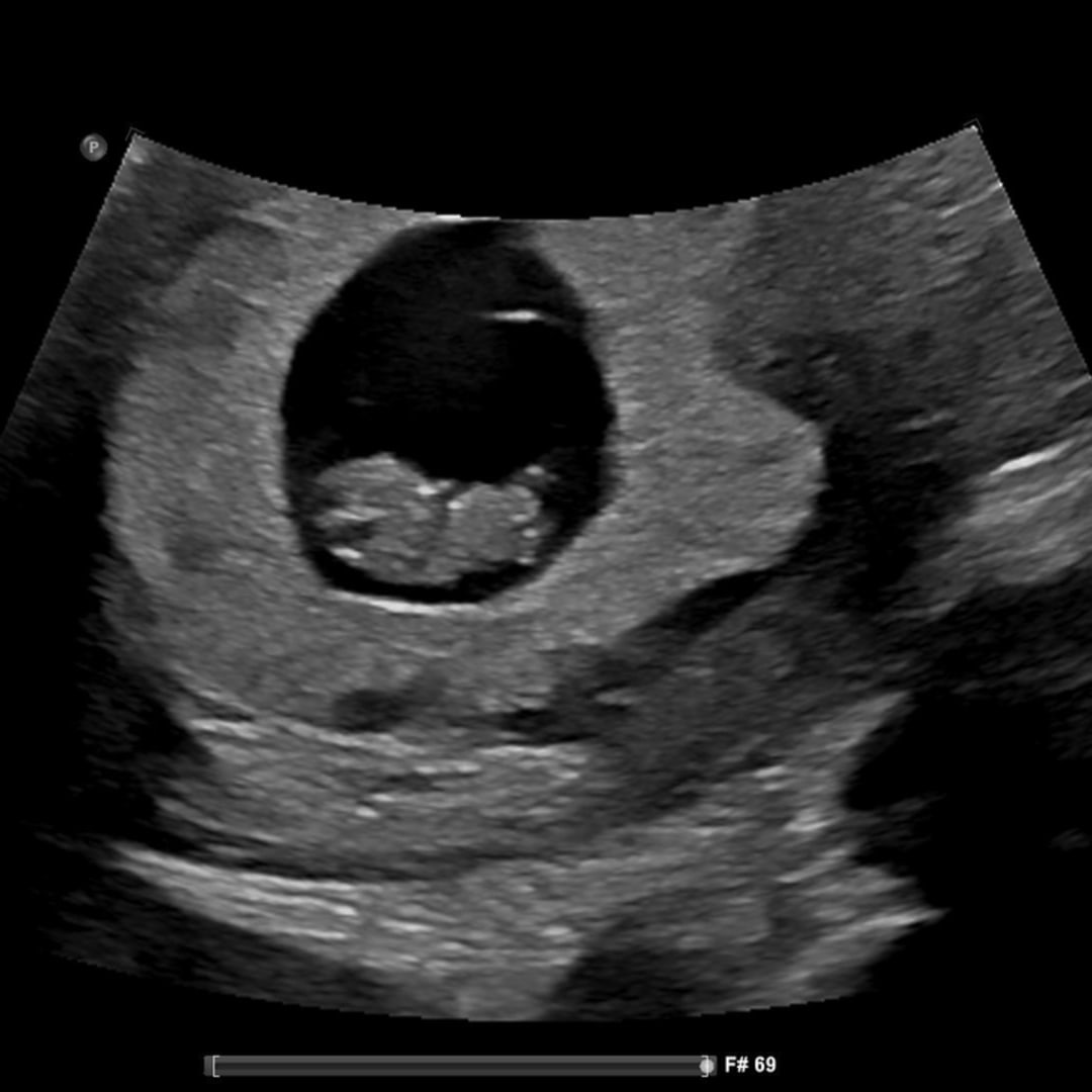 Photo shared by Charmaine for their Babylist baby registry.