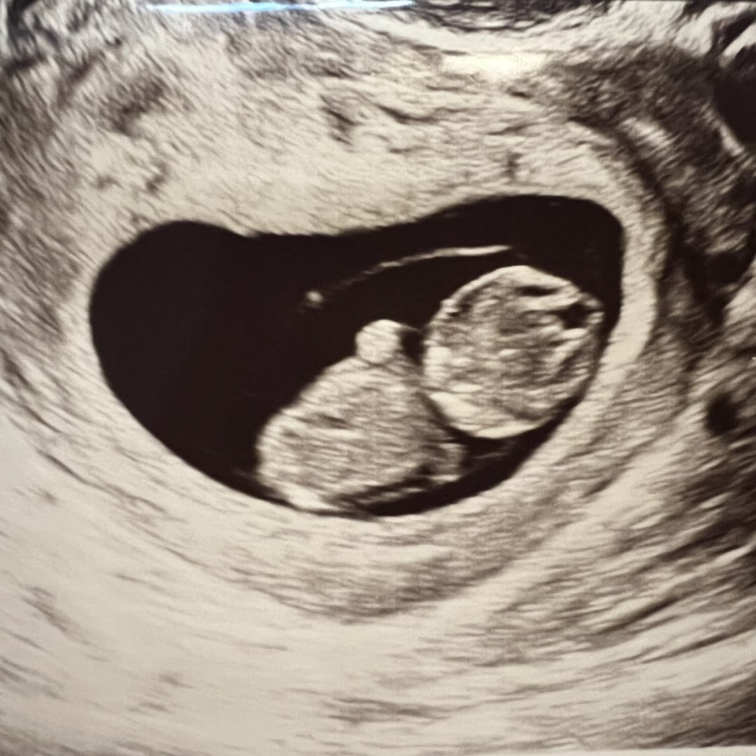 Photo shared by Danielle for their Babylist baby registry.