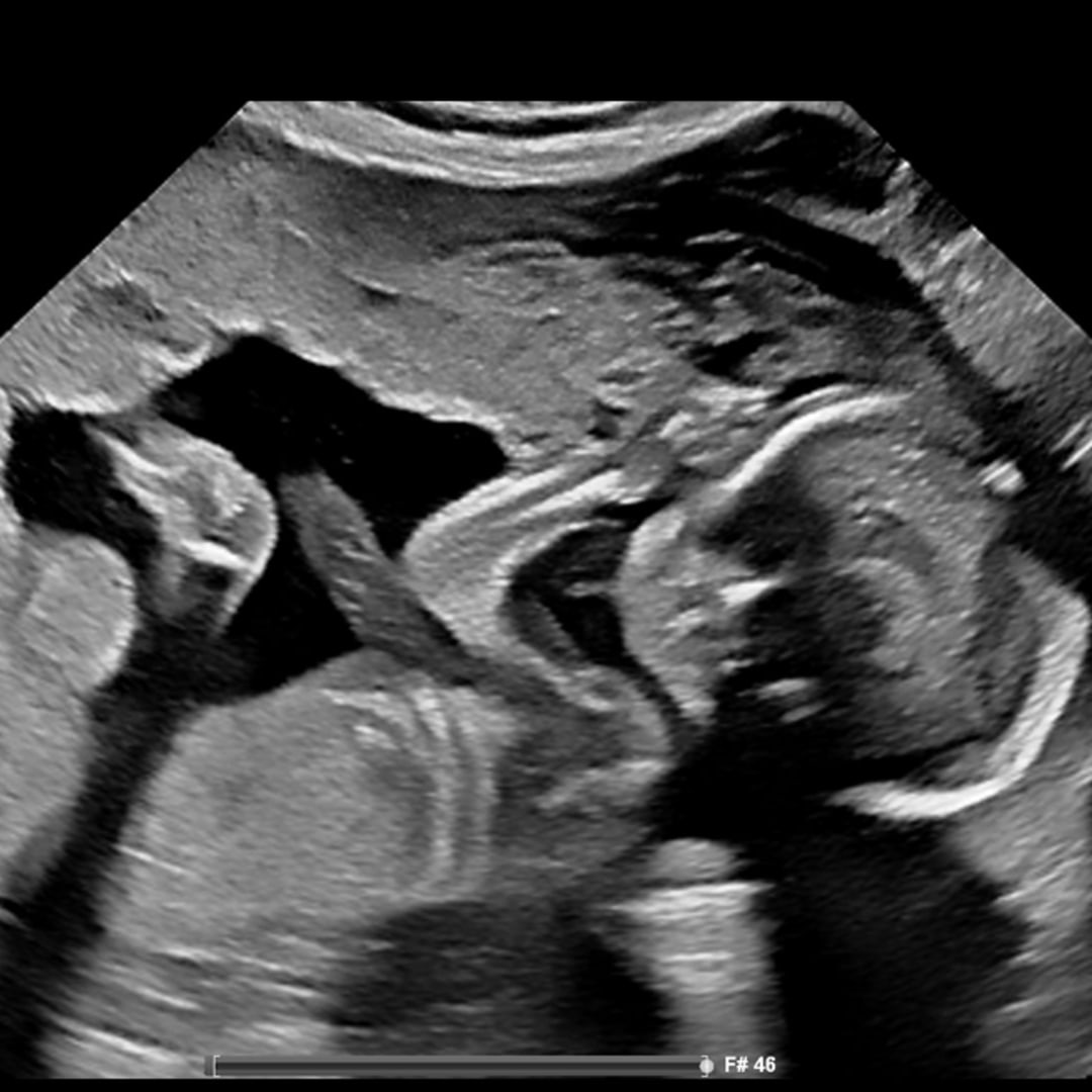 Photo shared by Yesenia for their Babylist baby registry.