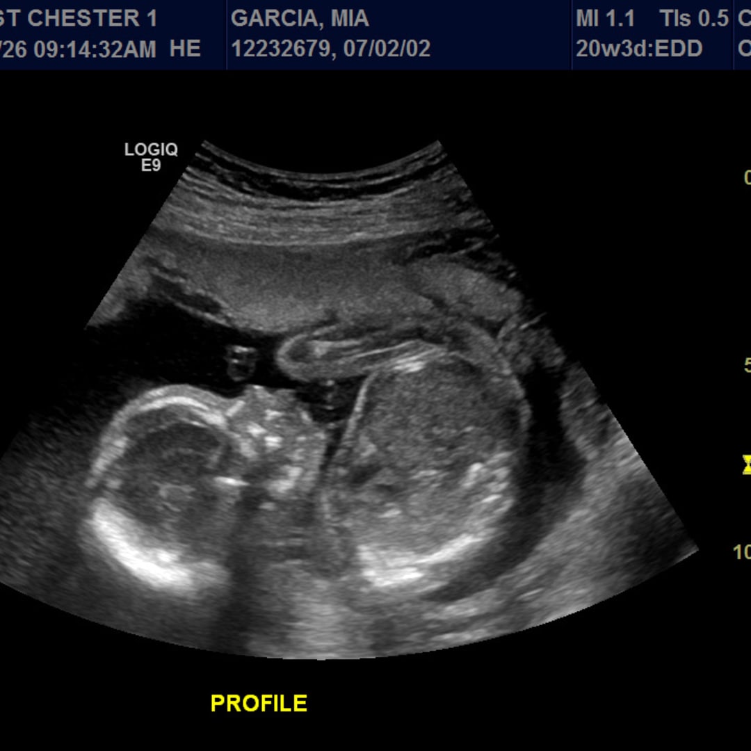 Photo shared by Mia for their Babylist baby registry.