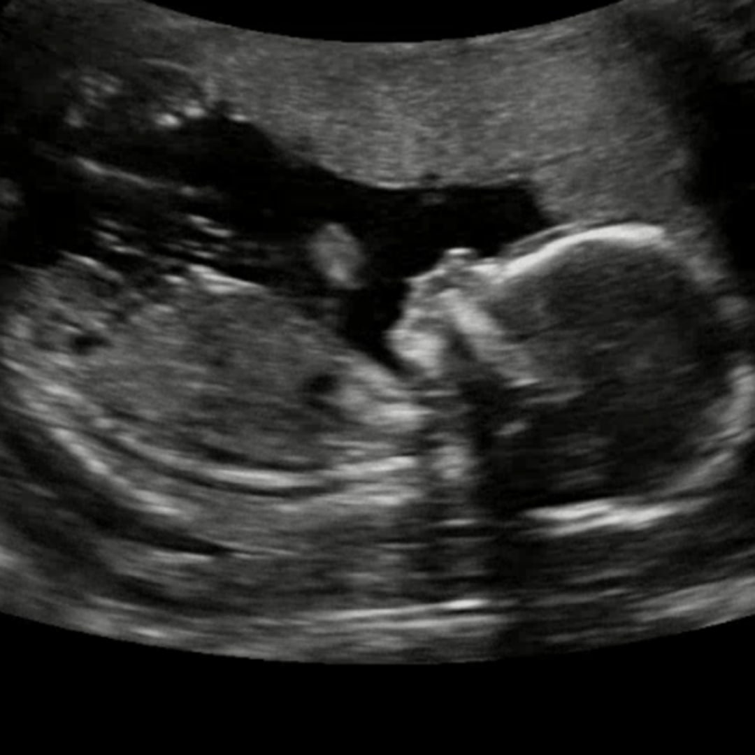 Photo shared by Carly for their Babylist baby registry.