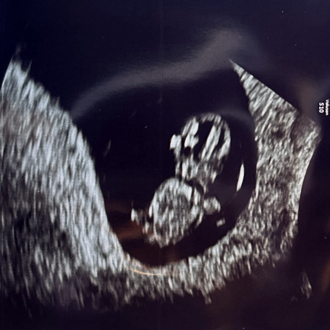 Photo shared by Ariana for their Babylist baby registry.