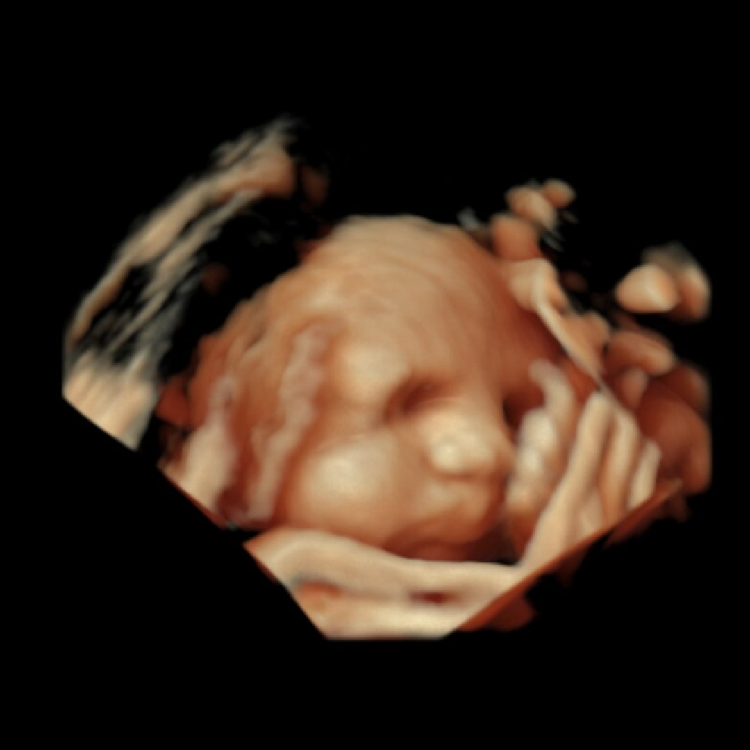 Photo shared by Carolin for their Babylist baby registry.