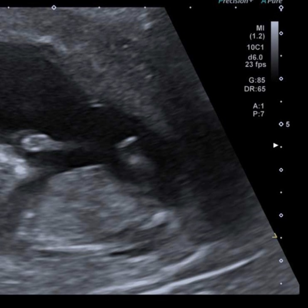 Photo shared by Josie for their Babylist baby registry.