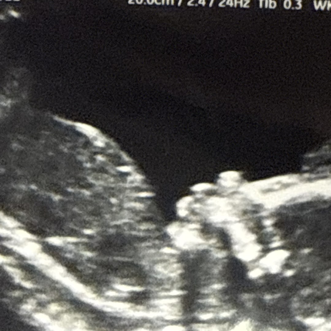 Photo shared by Alannah for their Babylist baby registry.